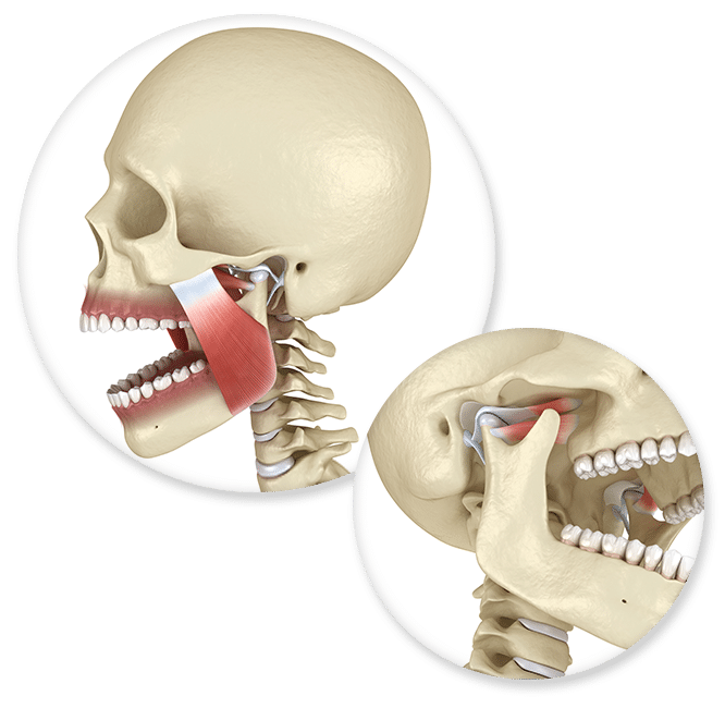 TMJ and Jaw Clenching Las Vegas